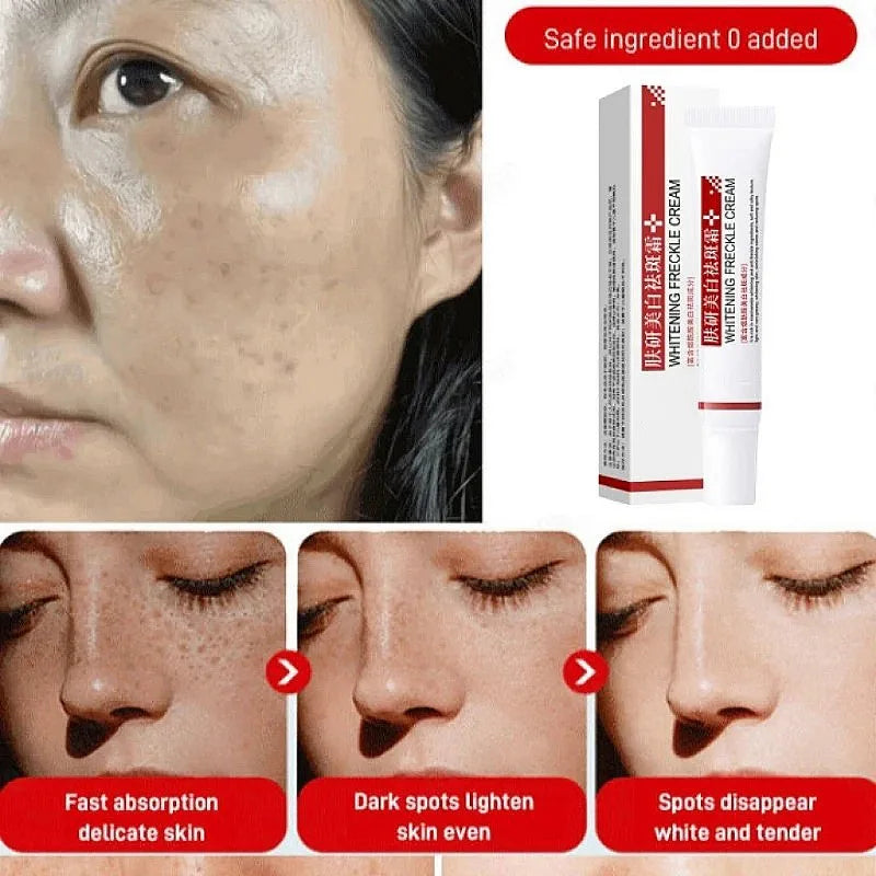 Face Quick Freckles Removal Cream Whitening Fade Spots Emulsion Remove Melasma Brighten Cream for Dark Skin Women Whiten Product