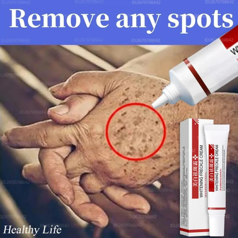 Face Quick Freckles Removal Cream Whitening Fade Spots Emulsion Remove Melasma Brighten Cream for Dark Skin Women Whiten Product