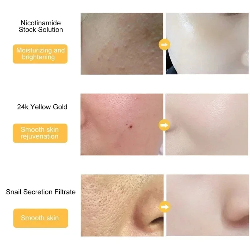 Face Care 24K Gold Serum Snail Collagen Face Essence Moisturizing Anti Aging Hyaluronic Acid Essence Brighten Skin Care Product