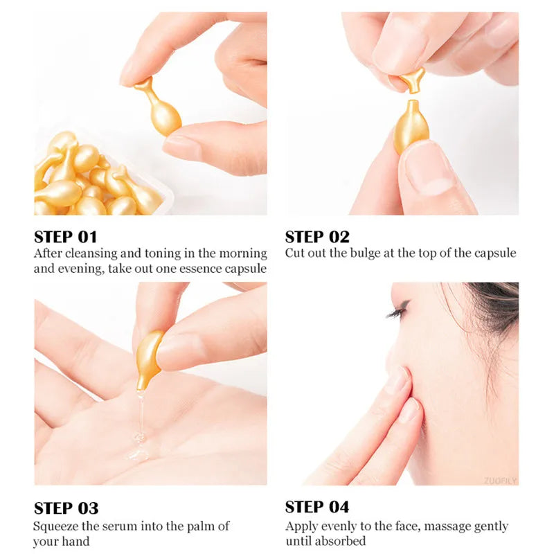 Cápsulas de ácido hialurônico, sérum removedor de acne, clareamento facial, anti-rugas, endurecimento, cosméticos de cuidados com a pele, 50 peças